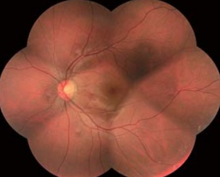 Vybavení oční ordinace MUDr. Blanka Prémová - obr2